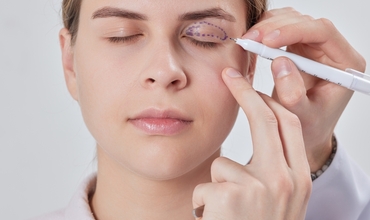 Üst Göz Kapağı Ameliyatı: Kimler İçin Uygun? Kimler Dikkat Etmeli?